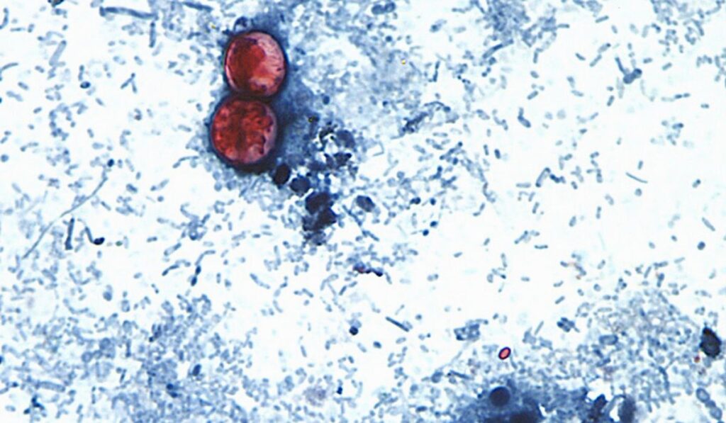Michigan reports the first 2 U.S. deaths related to a diarrhea-causing parasite